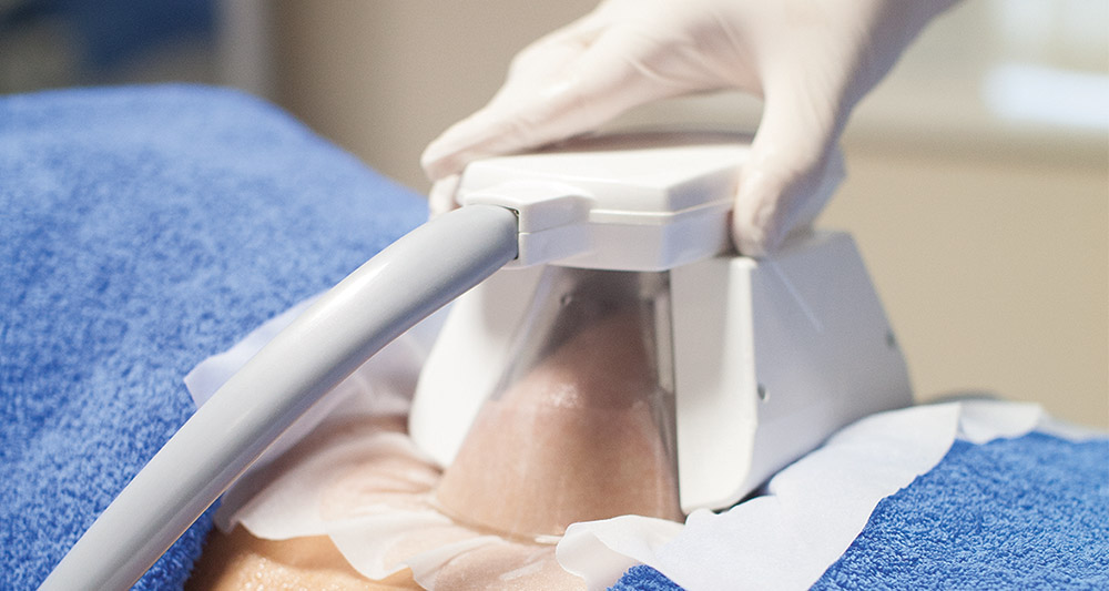 How Fat Freezing and HIFU Work Together? 2 Multiple Areas in One Session HIFU and Fat Freezing Halesowen