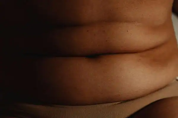 The Hidden Connection: How Stress Shapes Your Fitness and Body Composition 3 image of what stress can do on the stomach area and how Lipo 360 Halesowen can help to change your body shape.